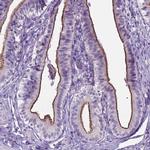 AP5B1 Antibody in Immunohistochemistry (Paraffin) (IHC (P))