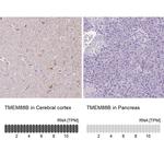 TMEM88B Antibody in Immunohistochemistry (IHC)