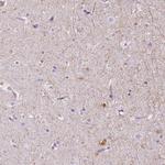 TMEM88B Antibody in Immunohistochemistry (IHC)