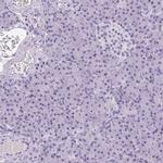 TMEM88B Antibody in Immunohistochemistry (IHC)