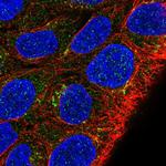 MKRN2OS Polyclonal Antibody