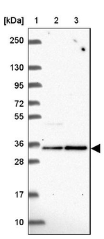 FN3KRP Antibody in Western Blot (WB)