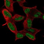 MIER3 Polyclonal Antibody