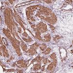 MIER3 Antibody in Immunohistochemistry (Paraffin) (IHC (P))