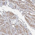 ANKRD58 Antibody in Immunohistochemistry (Paraffin) (IHC (P))