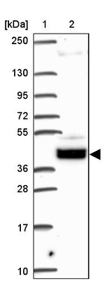 ANKRD58 Antibody in Western Blot (WB)