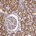 RNF123 Polyclonal Antibody