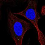 KIAA0895L Polyclonal Antibody