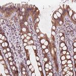 KIAA0895L Antibody in Immunohistochemistry (Paraffin) (IHC (P))