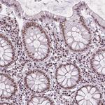 RPA4 Polyclonal Antibody