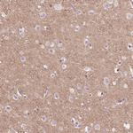 TM6SF2 Antibody in Immunohistochemistry (Paraffin) (IHC (P))