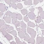 TM6SF2 Antibody in Immunohistochemistry (Paraffin) (IHC (P))
