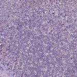 TM6SF2 Antibody in Immunohistochemistry (Paraffin) (IHC (P))