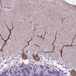 alpha-2b Adrenergic Receptor Polyclonal Antibody