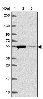 ZNF548 Antibody in Western Blot (WB)