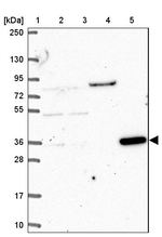 CLN6 Antibody in Western Blot (WB)