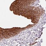 SMLR1 Antibody in Immunohistochemistry (Paraffin) (IHC (P))
