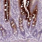 NUDT6 Polyclonal Antibody