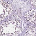 SPDYA Antibody in Immunohistochemistry (IHC)