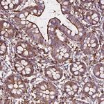 PATJ Antibody in Immunohistochemistry (Paraffin) (IHC (P))
