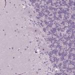 SMIM18 Antibody in Immunohistochemistry (Paraffin) (IHC (P))