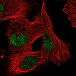 ZNF471 Polyclonal Antibody