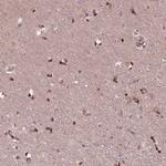 ZNF471 Antibody in Immunohistochemistry (Paraffin) (IHC (P))