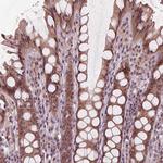 ZNF471 Antibody in Immunohistochemistry (Paraffin) (IHC (P))