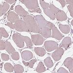 ZNF471 Antibody in Immunohistochemistry (Paraffin) (IHC (P))