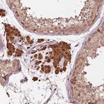 ZNF471 Antibody in Immunohistochemistry (Paraffin) (IHC (P))