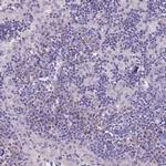 CD96 Antibody in Immunohistochemistry (IHC)