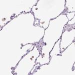 CD96 Antibody in Immunohistochemistry (IHC)
