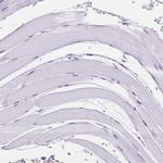 CD96 Antibody in Immunohistochemistry (IHC)