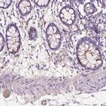 GDPD5 Polyclonal Antibody