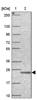 UBALD1 Antibody in Western Blot (WB)