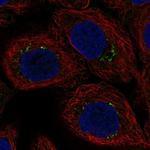 AP1S3 Antibody in Immunocytochemistry (ICC/IF)