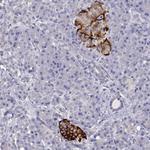 TMEM211 Antibody in Immunohistochemistry (Paraffin) (IHC (P))
