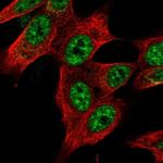 ZNF572 Polyclonal Antibody