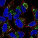 FAM181B Polyclonal Antibody