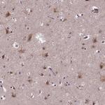 FAM181B Antibody in Immunohistochemistry (Paraffin) (IHC (P))