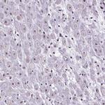 ATMIN Polyclonal Antibody