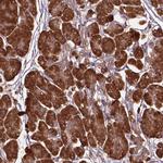 GAS1 Polyclonal Antibody