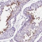 TMEM210 Polyclonal Antibody