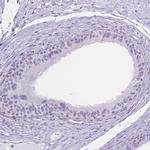 TMEM210 Antibody in Immunohistochemistry (IHC)