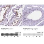 TMEM210 Antibody