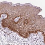 RAB22A Polyclonal Antibody