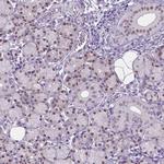 APCDD1L Polyclonal Antibody