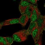 BTF3L4 Polyclonal Antibody