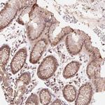 BTF3L4 Antibody in Immunohistochemistry (Paraffin) (IHC (P))