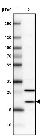 BTF3L4 Antibody in Western Blot (WB)